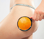 The battle against cellulite