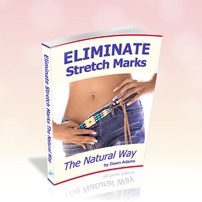 Eliminate Stretch Marks - The Natural Way eBook