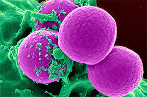 A new strain of MRSA bacteria has been discovered