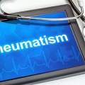 Rheumatism can be helped using only safe and natural methods