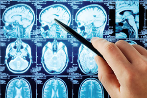 X-ray of the brain indicating the limbic system